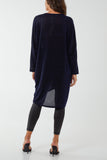 Glitter Lurex Twist Tie Knot Tunic Dress For Women  - Dropwear